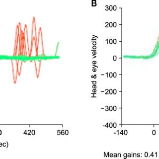 Different Patients With Similar Vestibulo Ocular Reflex Gain Could Have