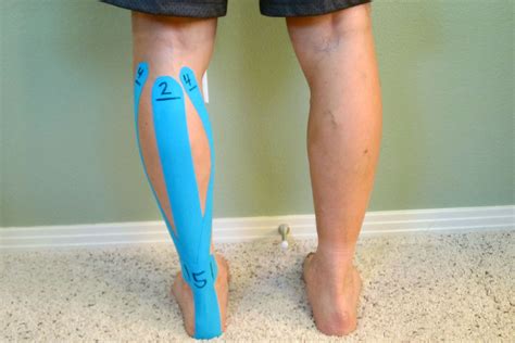 How To Rehabilitate Achilles Tendinitis The Physical Therapy Advisor