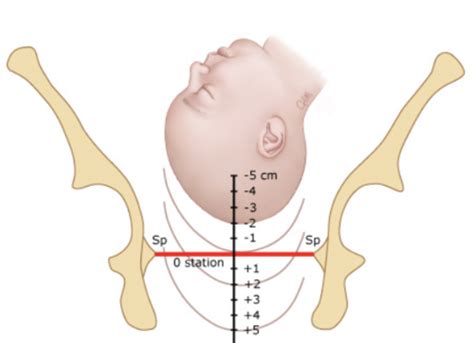 Labor And Delivery Flashcards Quizlet