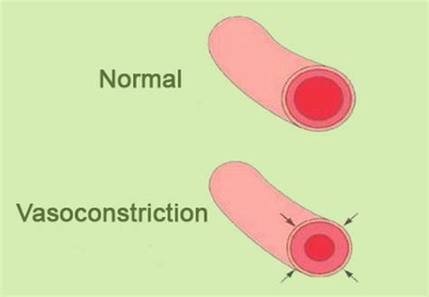 What is vasoconstriction ? definition, hypoxic and peripheral, causes ...