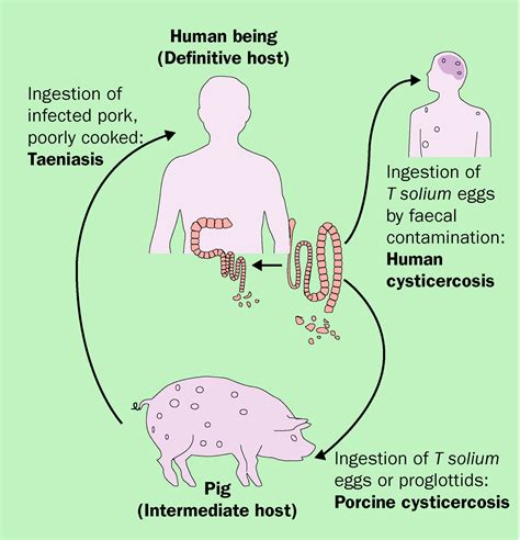 Taenia Solium Cysticercosis The Lancet