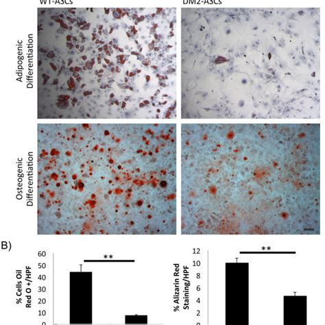 Adipose Derived Mesenchymal Stem Cell ASC Adipogenic And Osteogenic