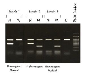 Ways To Determine Genotypes Using Gel Electrophoresis Genetic Education