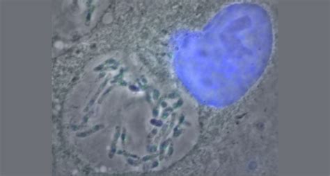 microbes living systems institute university  exeter