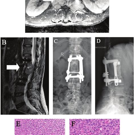 Pre And Post Operative Radiographic Images And Pathological Appearance