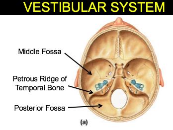 Petrous Ridge Of Temporal Bone