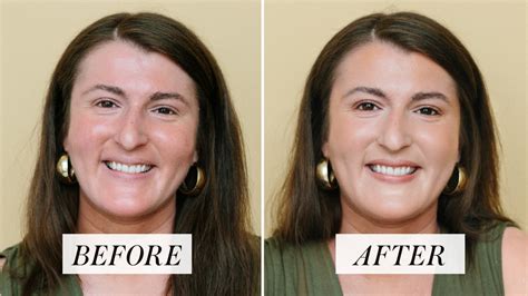 My Foundation Routine For Covering Up Facial Redness In Five Minutes