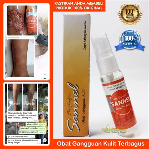 Jual Sannel Original Obat Herbal Spray Gangguan Penyakit Kulit Bisul