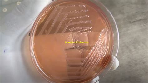 Lactose Fermenter Lf And Non Lactose Fermenter Nlf Gram