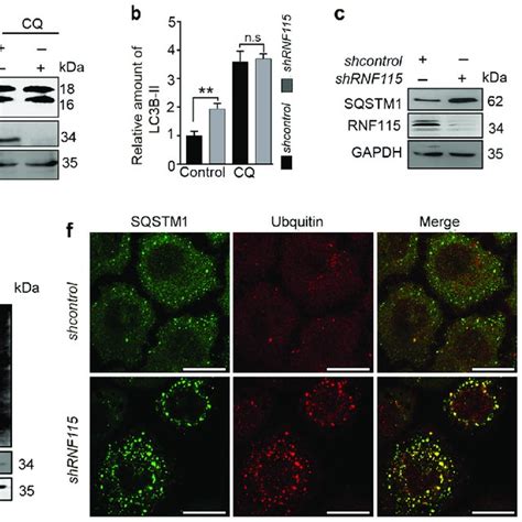 Knockdown Of Rnf Impairs The Fusion Of Autophagosome With Lysosome