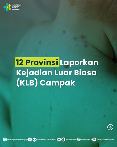 Kementerian Kesehatan RI On Twitter Sebanyak 12 Provinsi Melaporkan