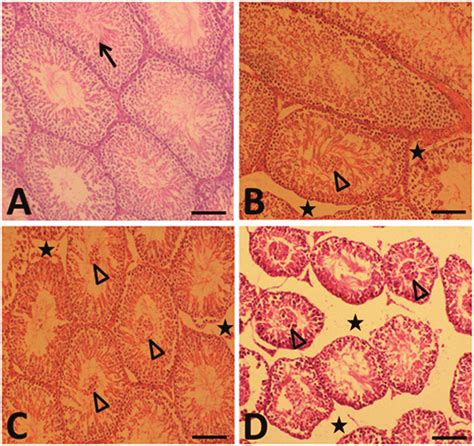 Photomicrographs Of Hande Stained Sections Of Testes Scale Bar 50 µm