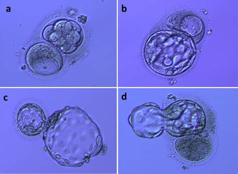 Blastocyst Hatching