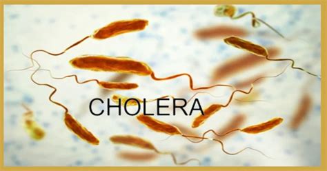 Cholera Causes Symptoms Treatment And Prevention Your Ultimate