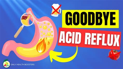 5 Ways To Naturally Stop Acid Reflux How To Stop Acid Reflux