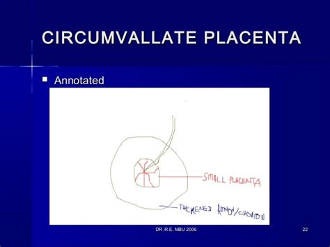 The placenta and its abnormalities