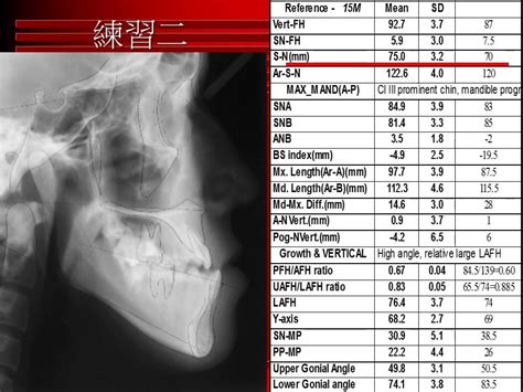 Ortho Ceph Tracing And Analysis Youtube