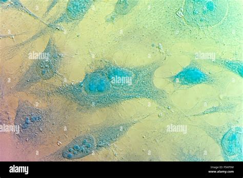 Cervical Cancer Cells Hi Res Stock Photography And Images Alamy