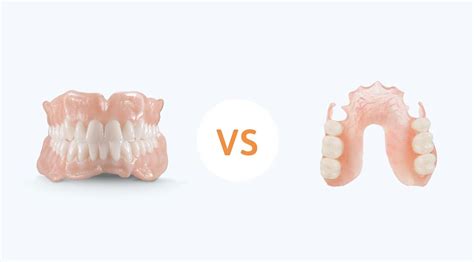 The Benefits of Full Dentures vs. Partial Dentures