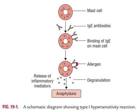 Anaphylactic Hypersensitivity Medizzy