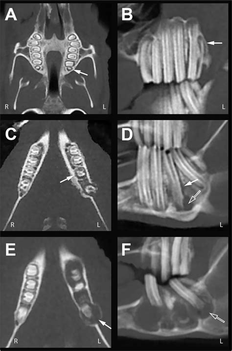 Periodontal Ligament Radiograph