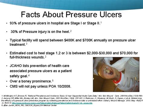 Heel Pressure Ulcers Prevalence Cost Etiology And Risk