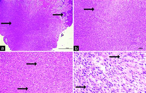 Histopathology Of The Lesion A Photomicrograph Showing Highly