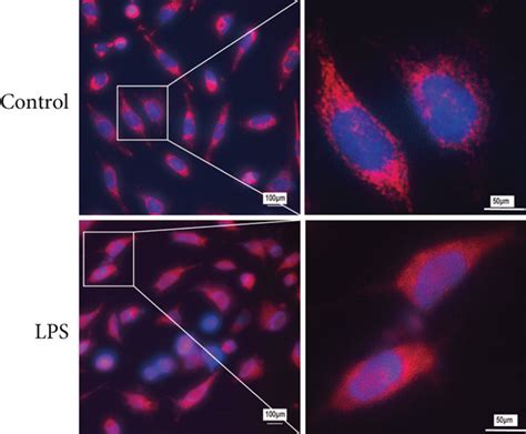 Lps Induced Mitophagy In A Cells And Mouse Lung Tissues A