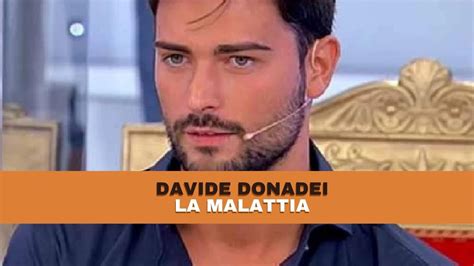 Davide Donadei Il Racconto Shock Sulla Malattia Volto Sfigurato Dopo