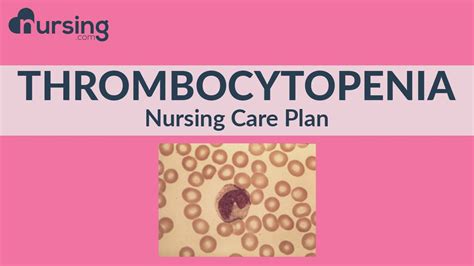 Nursing Care Plan For Thrombocytopenia Nursing Care Plan Tutorial Youtube