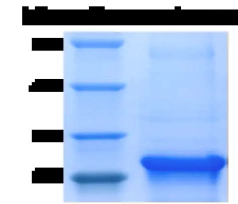 Bluegene Recombinant Proteins Interleukin Proteins