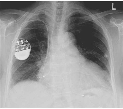 What is Bioelectronics?