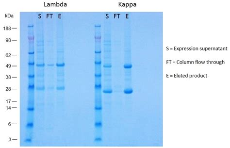 Kappa Lambda Light Chains Free With Ratio Serum High Shelly Lighting