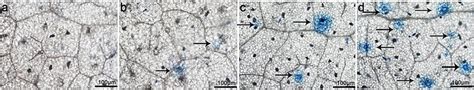 Staining With Trypan Blue Followed By Direct Observations Through An