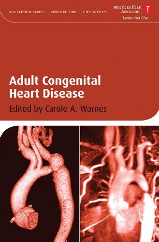 Adult Congenital Heart Disease American Heart Association Clinical