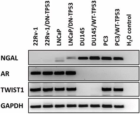 Influences Of Tp And The Anti Aging Ddr Receptor In Controlling Raf