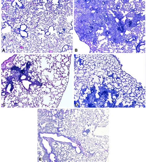 Comparison Of Lung Parenchyma From Mice Immunized With Comp Hsp Or