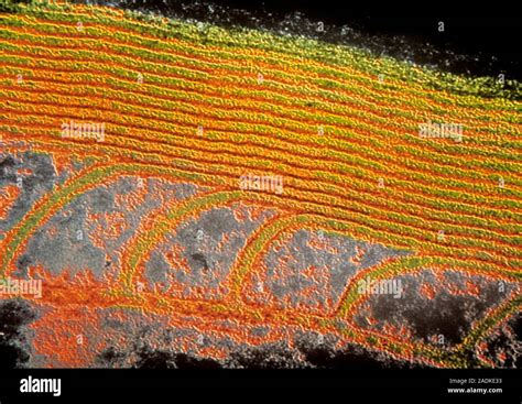 False Colour Transmission Electron Micrograph TEM Showing The Myelin