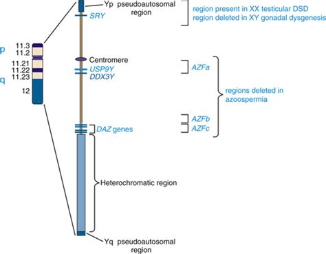 Sex Chromosomes And Their Abnormalities Basicmedical Key