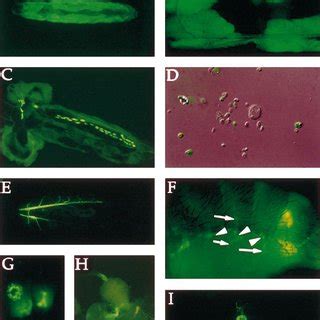 The Drosomycingfp Reporter Gene Is Expressed In The Fat Body During