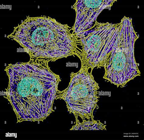 Cancer Cell Division Immunofluorescent Light Micrograph Of Cancer