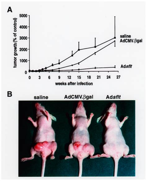 Regression of Human Breast Carcinoma in Nude Mice after Adsflt Gene