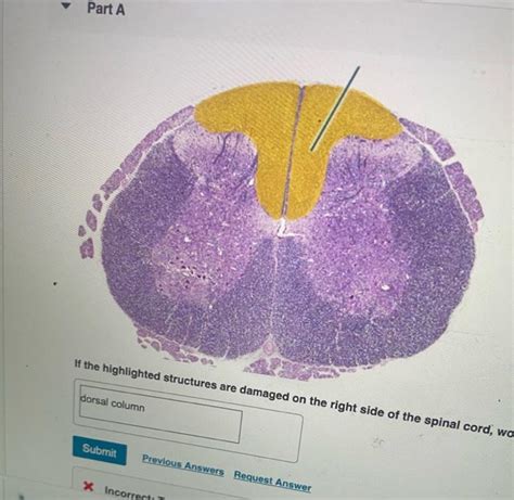 Solved Pal Histology Nervous Tissue Lab Practical Chegg