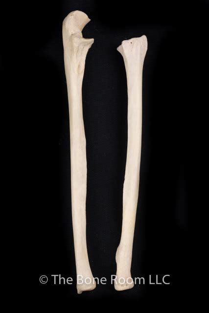 Human Radius & Ulna Set