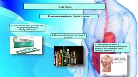 Sindrome Hemorragico Digestivo Ucs Pptx Descarga Gratuita