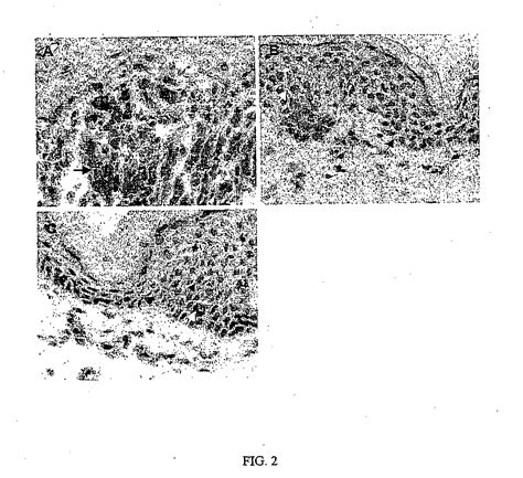 Inflammatory dermatosis patented technology retrieval search results