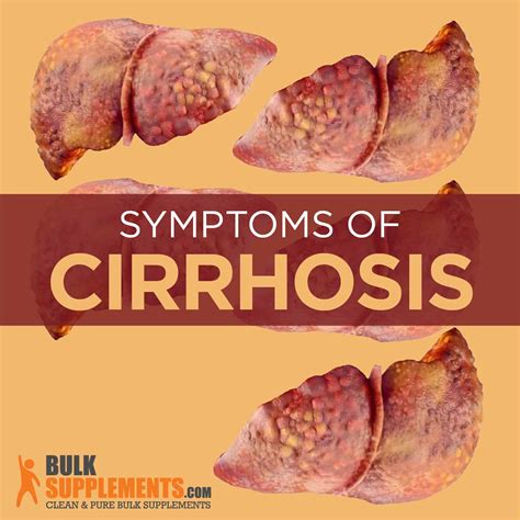 Early Cirrhosis Symptoms