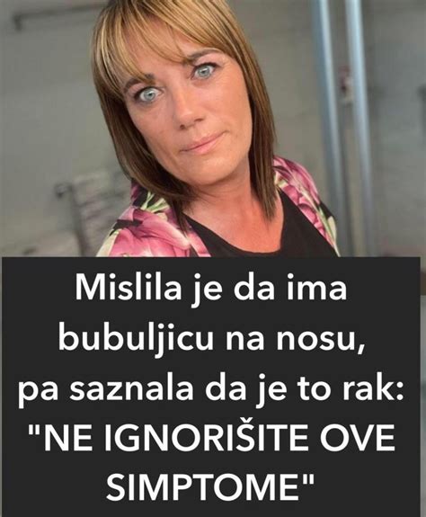 OVA ŽENA JE MISLILA DA JOJ JE ISKOČILA BUBULJICA NA LICU PA SAZNALA DA