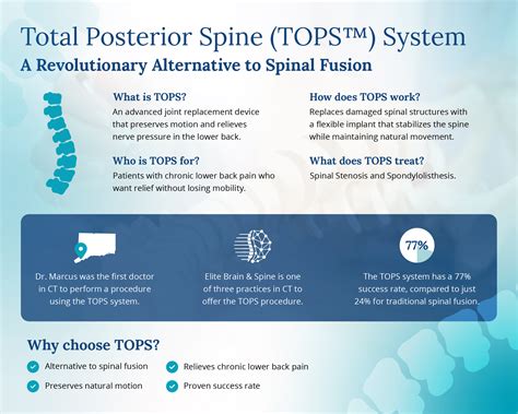 Total Posterior Spine (TOPS) System | Elite Brain & Spine