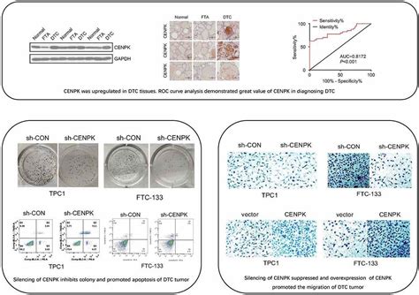 Full Article Overexpression Of Centromere Protein K Cenpk Gene In